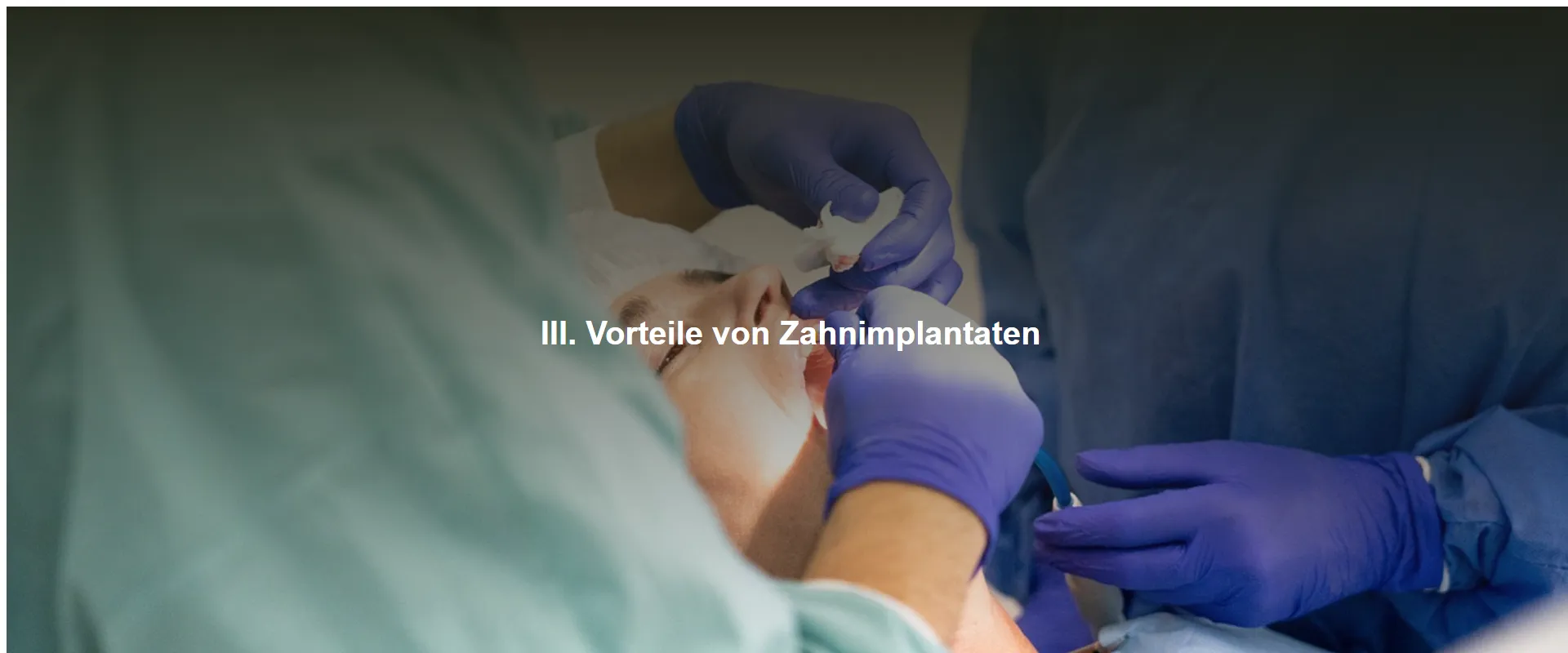 Vorteile von Zahnimplantaten